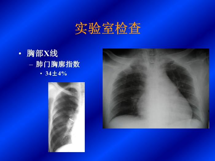 【醫學PPT課件】肺動脈高壓-首都醫科大學附屬北京朝陽醫院-北京市呼吸病研究所第10頁
