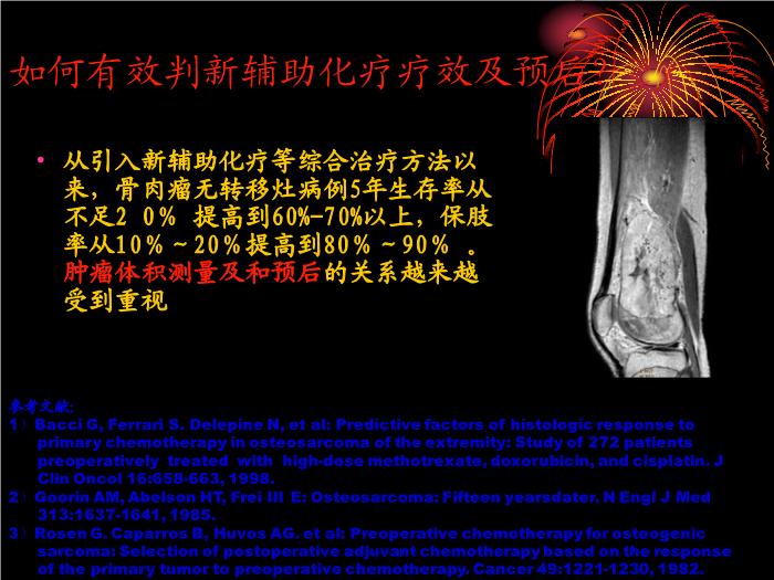 【醫學PPT課件】骨肉瘤治療中體積測量的方法和價值  天津骨科醫院腫瘤科第2頁