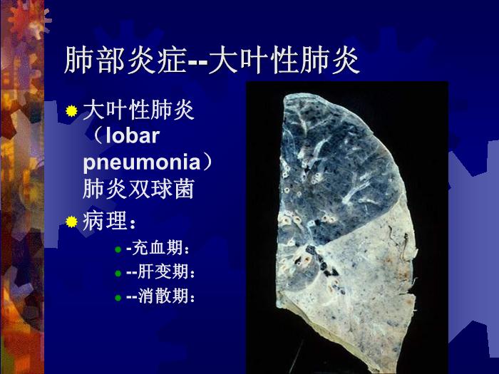 【醫學PPT課件】肺部炎癥課件-天鐵醫院放射中心-PPT課件第3頁