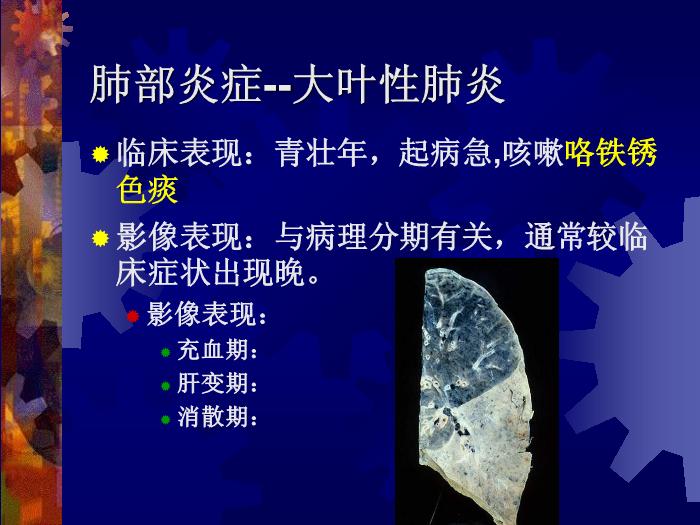 【醫學PPT課件】肺部炎癥課件-天鐵醫院放射中心-PPT課件第4頁