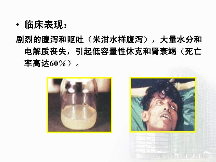 【醫學PPT課件】弧菌屬  醫學微生物學教學課件第14頁