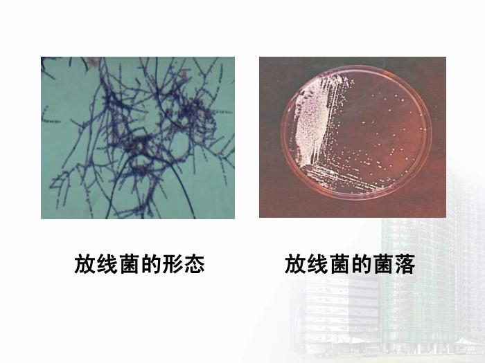 【醫學PPT課件】放線菌屬與諾卡菌屬 醫學微生物學教學課件第7頁