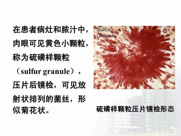 【醫學PPT課件】放線菌屬與諾卡菌屬 醫學微生物學教學課件第8頁