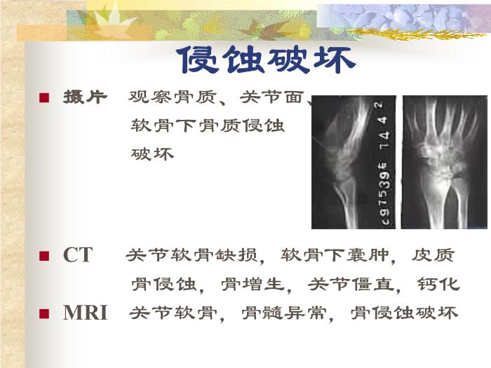 【醫學PPT課件】關節影像學診斷_PPT課件第8頁