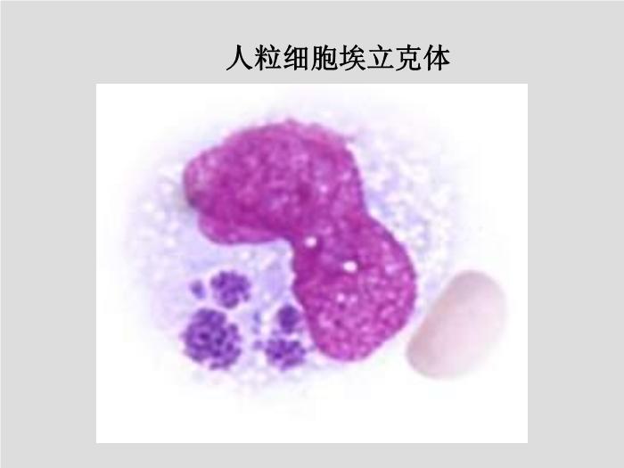 【醫學PPT課件】立克次體 第三軍醫大學  汪正清第14頁