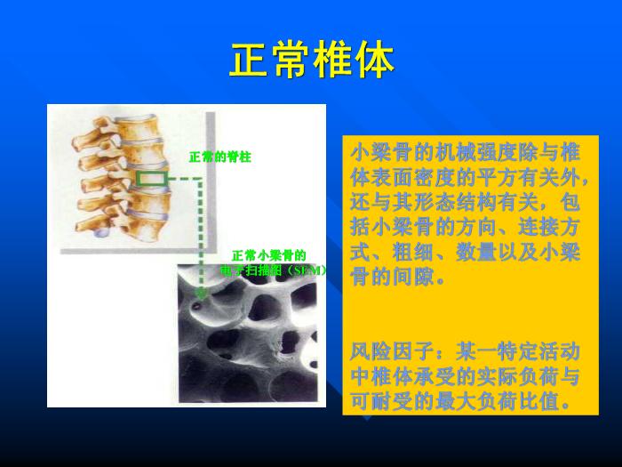 【醫學PPT課件】骨質疏松癥 重慶醫科大學附屬一院骨科第8頁