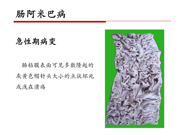 【醫學PPT課件】第二十一章 寄生蟲病 病理學教學課件第11頁