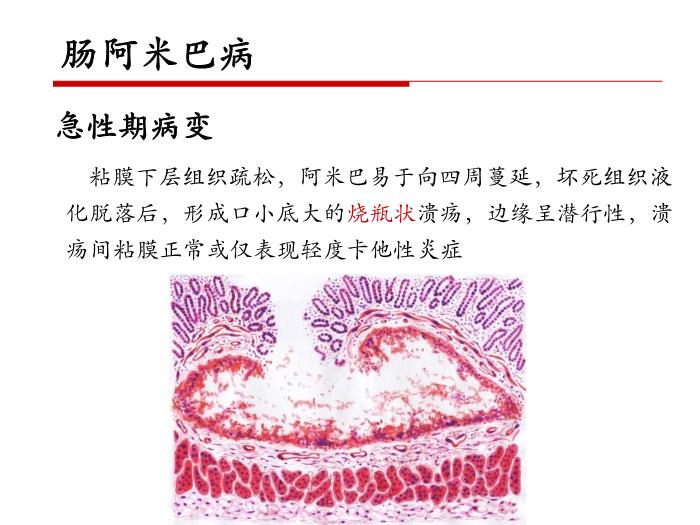 【醫學PPT課件】第二十一章 寄生蟲病 病理學教學課件第12頁