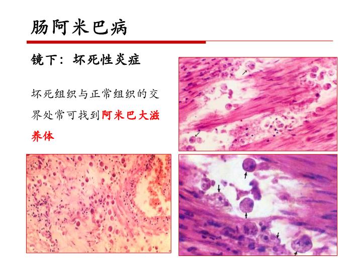 【醫學PPT課件】第二十一章 寄生蟲病 病理學教學課件第13頁