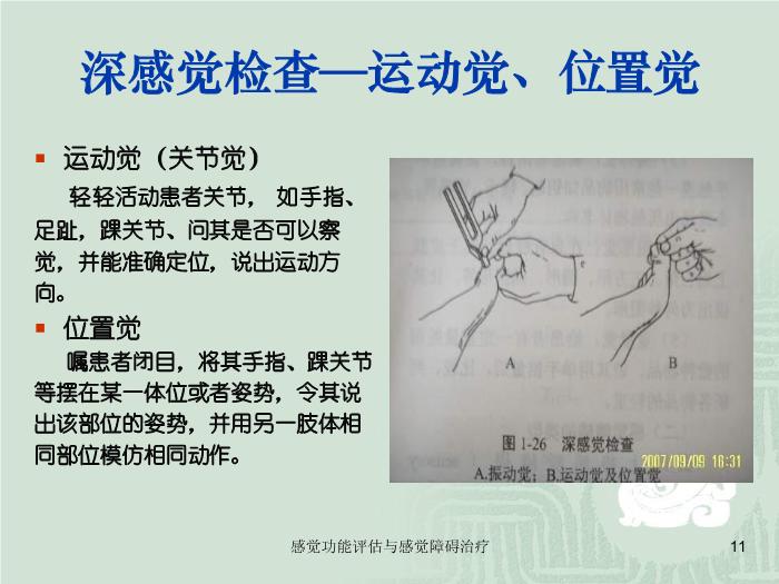 【醫學PPT課件】感覺功能的評估以及感覺障礙的治療第11頁