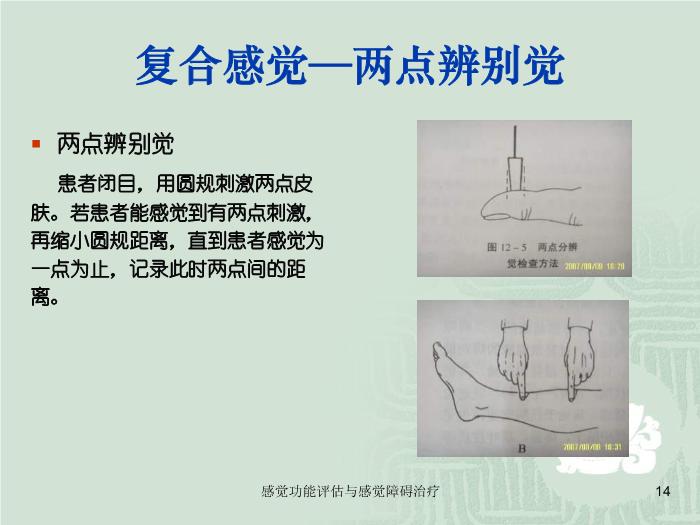 【醫學PPT課件】感覺功能的評估以及感覺障礙的治療第14頁