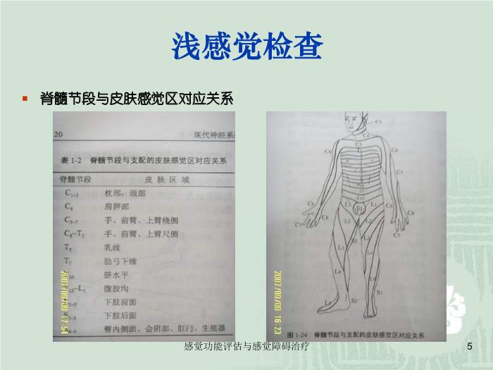 【醫學PPT課件】感覺功能的評估以及感覺障礙的治療第5頁