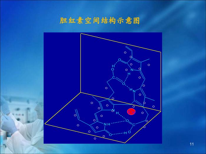 【醫學PPT課件】第16章 肝膽疾病的生物化學診斷（人衛）第11頁