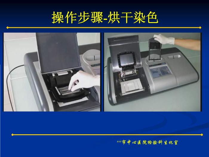 【醫學PPT課件】蛋白電泳技術的臨床應用 蛋白電泳技術和多發性骨髓瘤簡介第10頁