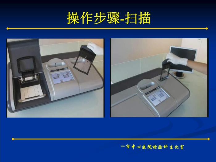【醫學PPT課件】蛋白電泳技術的臨床應用 蛋白電泳技術和多發性骨髓瘤簡介第11頁