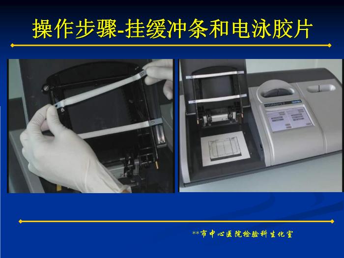 【醫學PPT課件】蛋白電泳技術的臨床應用 蛋白電泳技術和多發性骨髓瘤簡介第7頁