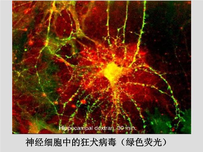 【醫學PPT課件】第30章 其他病毒、朊粒 大連醫科大學  第12頁