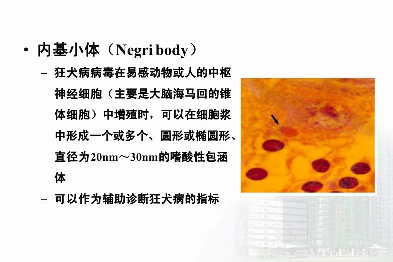 【醫學PPT課件】第33章 其他病毒 醫學微生物學教學課件第10頁