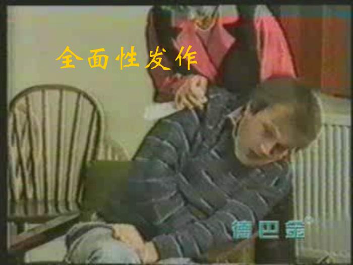 【醫學PPT課件】癲癇的診斷及鑒別診斷第8頁