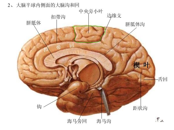 【醫學PPT課件】端腦-27頁精美圖片幻燈片第6頁