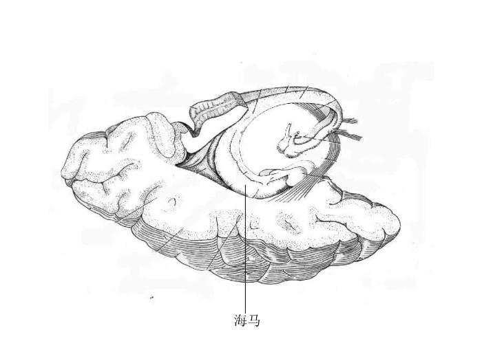 【醫學PPT課件】端腦-27頁精美圖片幻燈片第8頁