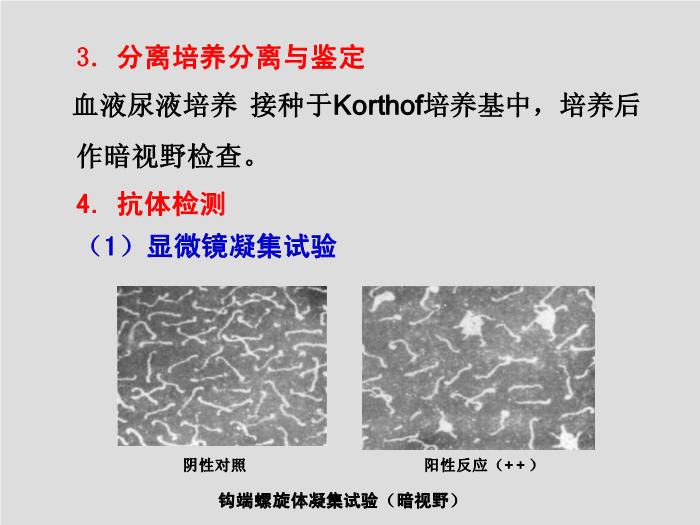 【醫學PPT課件】螺旋體 第三軍醫大學  汪正清第9頁